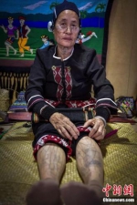 75岁的黎族阿婆符金花展示腿部文身。骆云飞 摄 - 中新网海南频道