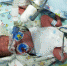 海口深夜一男婴被遗弃垃圾桶边 多方援救命悬一线小生命 - 海南新闻中心
