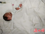 海南屯昌一初生婴儿患肠梗阻靠口鼻排泄 父母苦筹手术费 - 海口网